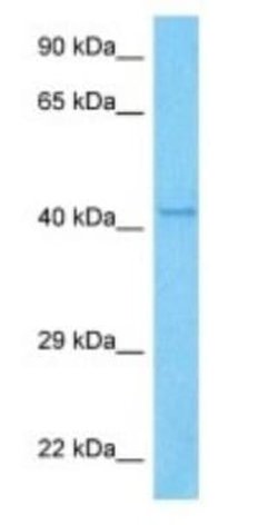 TRIM49B Rabbit anti-Human, Polyclonal, Novus Biologicals 100 &mu;g | Buy Online | Novus Biologicals | Fisher Scientific